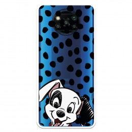 Coque pour Xiaomi Poco X3...