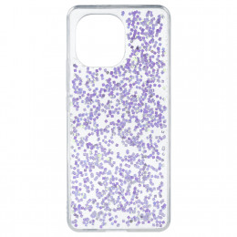 Funda Glitter Premium para Xiaomi Mi 11